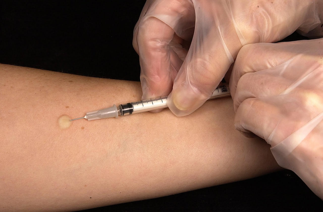 Il test cutaneo, detto prick test