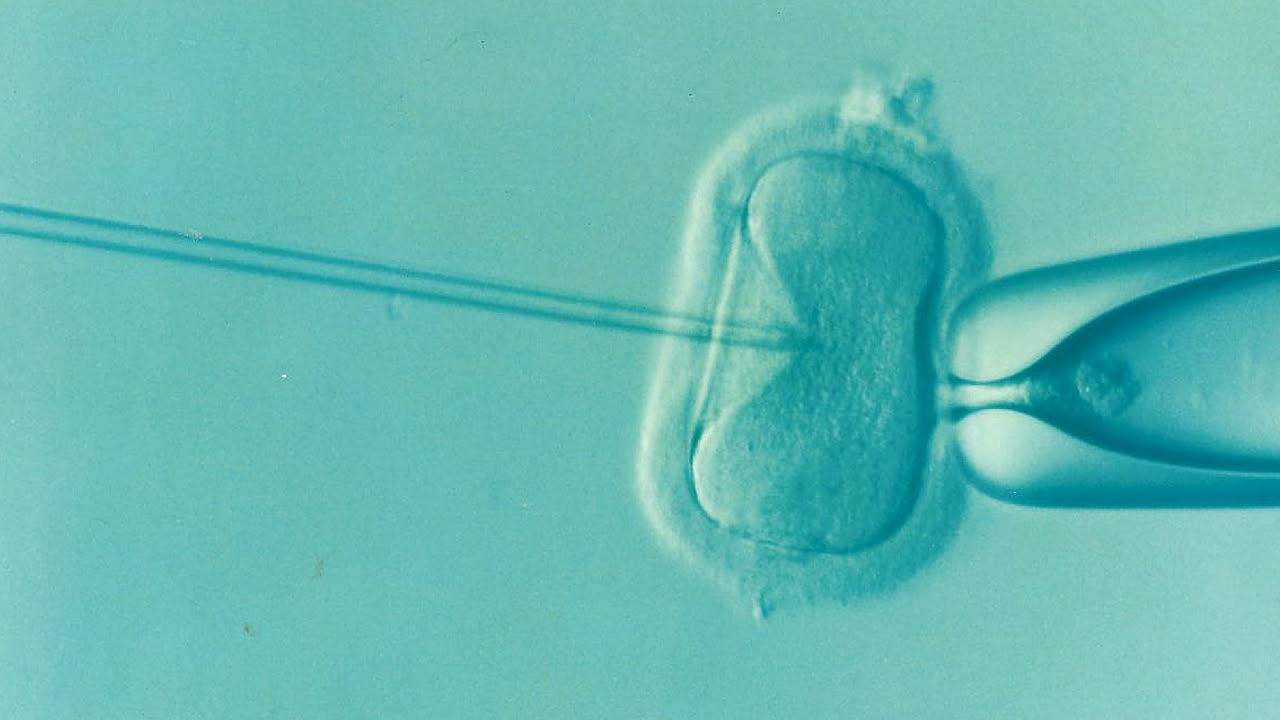 Cariotipo: quando il medico lo prescrive davvero e perché