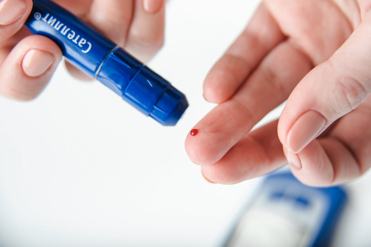 Analisi del sangue con i valori del colesterolo LDL, HDL e colesterolo totale su un referto medico cartaceo, con uno stetoscopio blu accanto